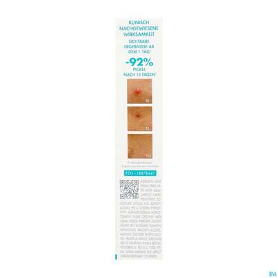 Sie sehen eine Packung Avene Cleanance Comedomed Intensiv Anti-pickel Akutpflege 40ml, Produktbild: 06 Avene Cleanance Comedomed Intensiv Anti-pickel Akutpflege 40ml, A-Nr.: 5899040 - 06