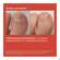 Isdin Si-nails Micoxpert 4,5ml, A-Nr.: 5744952 - 09