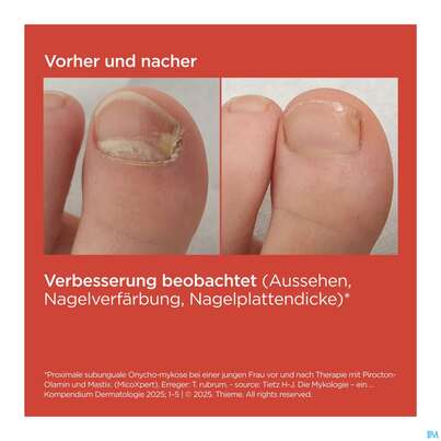 Isdin Si-nails Micoxpert 4,5ml, A-Nr.: 5744952 - 09